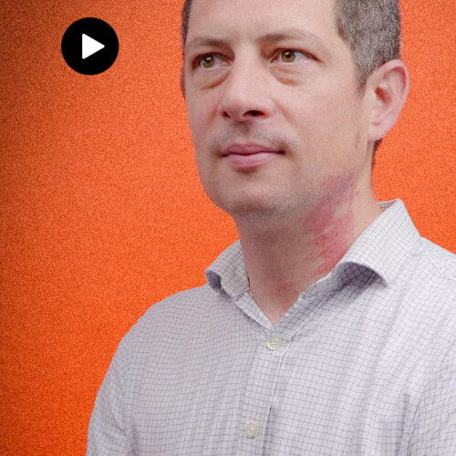 « Il n’y a pas assez de médecins en France » / Infox !